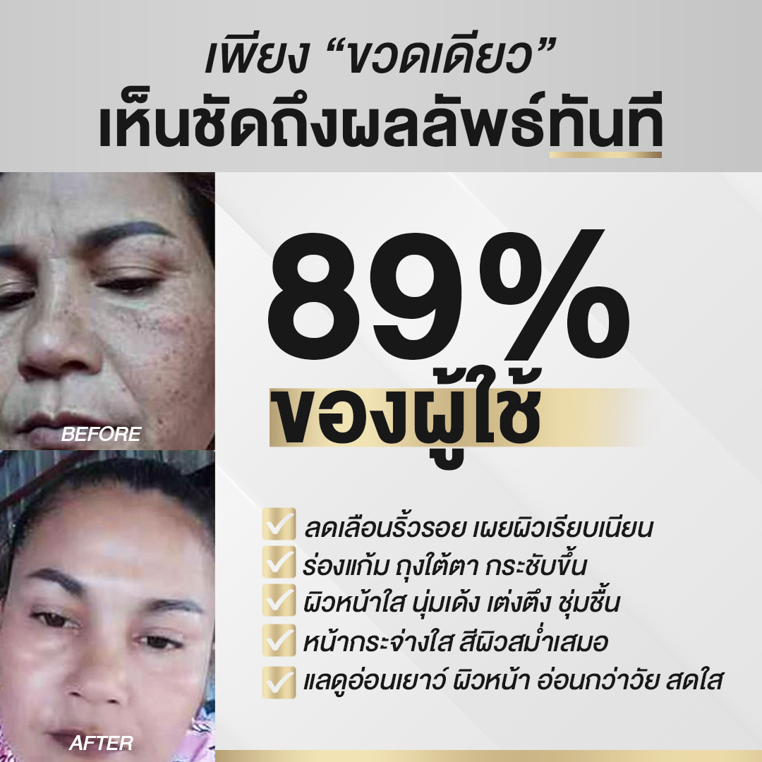 นิสิต CG [ 5 ขวด ] เซรั่มขวดทอง “กิ๊ก สุวัจนี” คืนความอ่อนเยาว์ผิวหน้า เซรั่มเพื่อคนไม่ยอมแก่ NISIT CG นิสิตซีจี