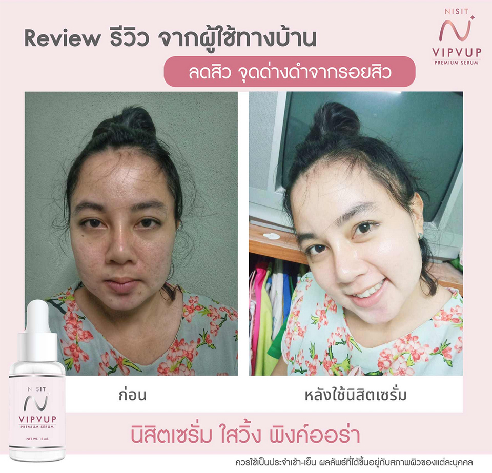 รีวิว นิสิตเซรั่ม Nisit Serum นิสิต วิบวับ เซรั่ม