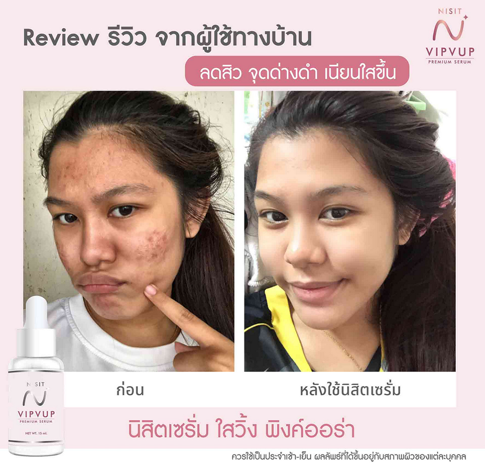 รีวิว นิสิตเซรั่ม Nisit Serum นิสิต วิบวับ เซรั่ม