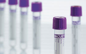 หลอดเก็บเลือด ฝาม่วง EDTA K3 ขนาด 2ml - Greiner Bio-One ,Austria