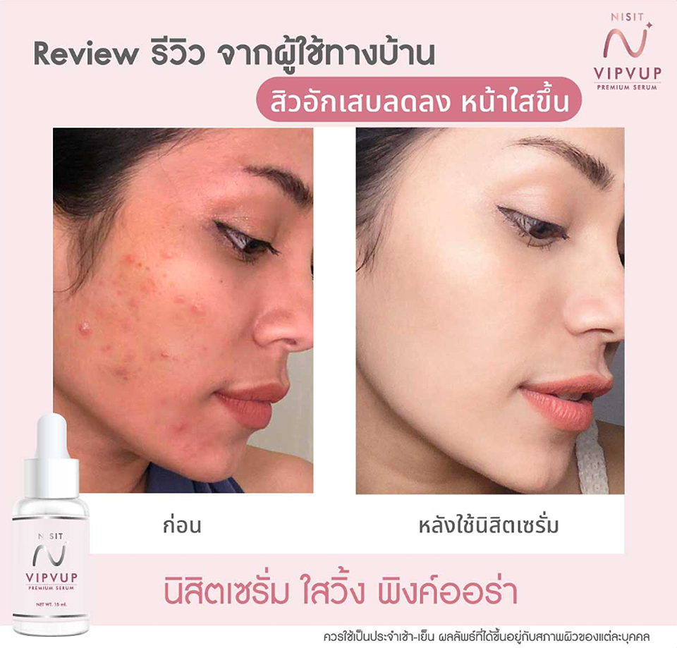 รีวิว นิสิตเซรั่ม Nisit Serum นิสิต วิบวับ เซรั่ม