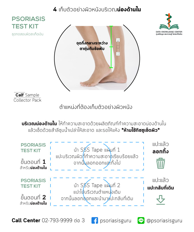 ชุดตรวจสอบสะเก็ดเงิน (49 บาท = 29+ค่าส่ง 20)