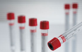 หลอดเก็บเลือด ฝาแดง ขนาด 4ml (50pcs/pk)