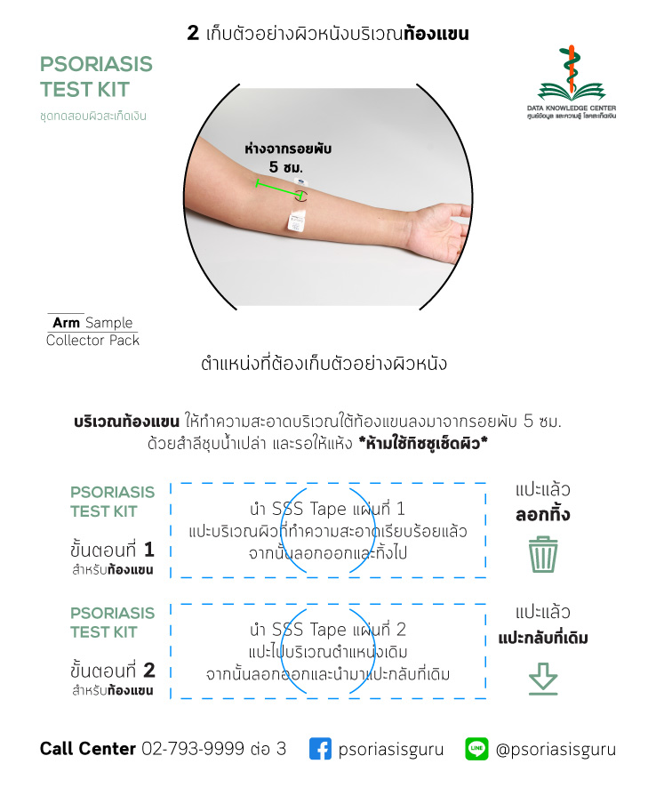 ชุดตรวจสอบสะเก็ดเงิน (49 บาท = 29+ค่าส่ง 20)