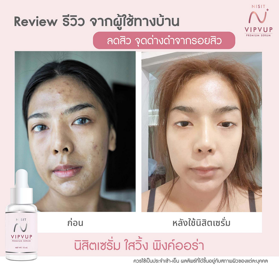 รีวิว นิสิตเซรั่ม Nisit Serum นิสิต วิบวับ เซรั่ม