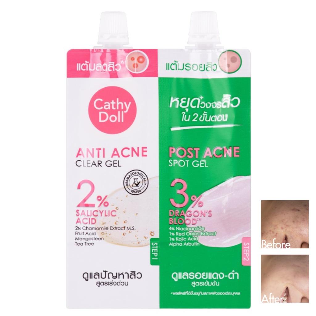 CATHY DOLL เคที่ดอลล์ ทูสเต็ปแอคเน่แคร์เซ็ท ชุดเจลแต้มสิวและเจลแต้มรอยสิว (3กรัม+3กรัม) 2 STEP ACNE CARE SET (3G+3G)