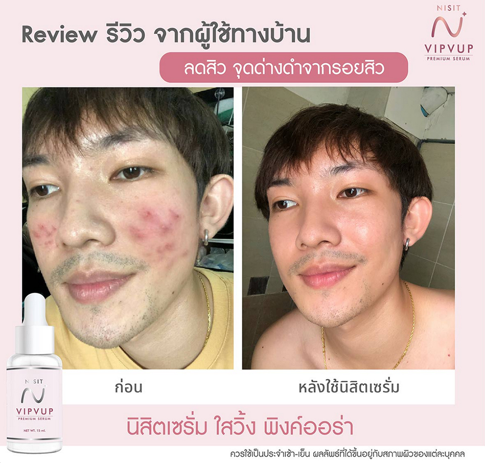 รีวิว นิสิตเซรั่ม Nisit Serum นิสิต วิบวับ เซรั่ม