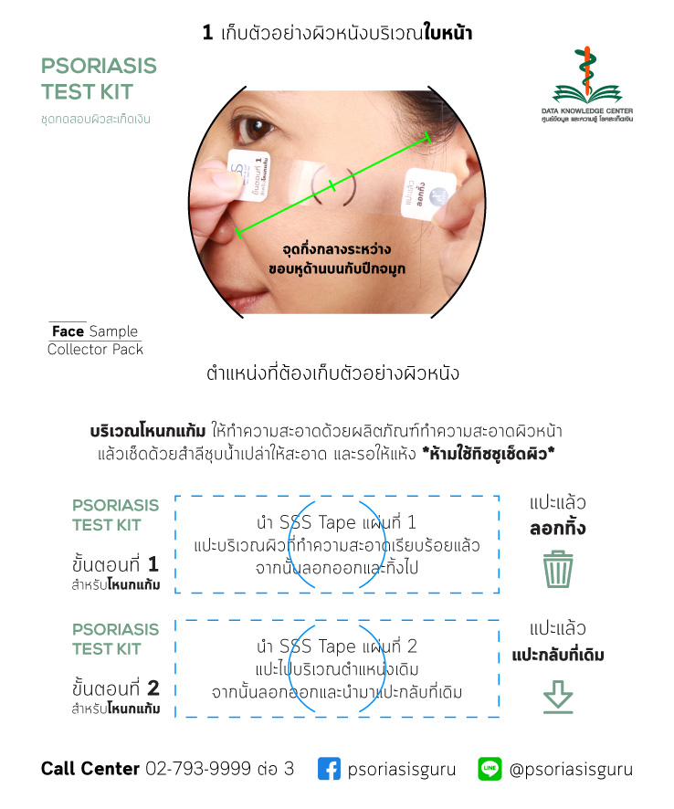 ชุดตรวจสอบสะเก็ดเงิน (49 บาท = 29+ค่าส่ง 20)