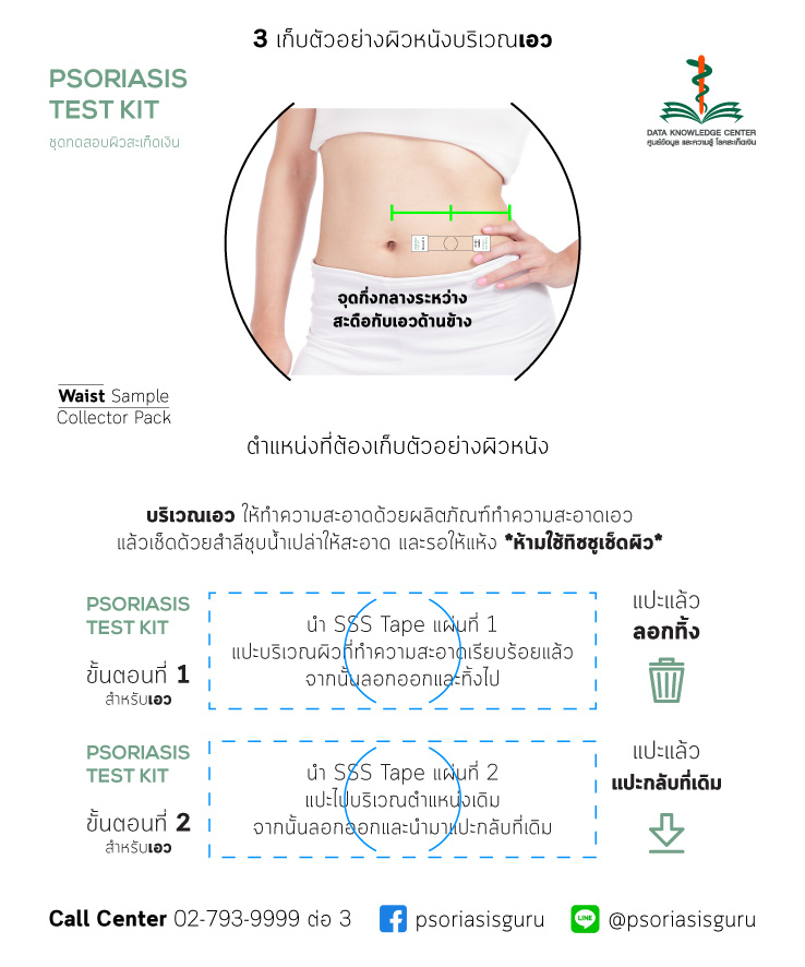 ชุดตรวจสอบสะเก็ดเงิน (49 บาท = 29+ค่าส่ง 20)