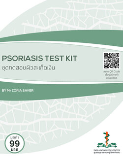 ชุดตรวจสอบสะเก็ดเงิน (49 บาท = 29+ค่าส่ง 20)